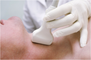 la glande thyroïde thyroïde